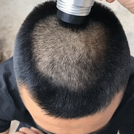 gifbre Hair Refilling Fiber